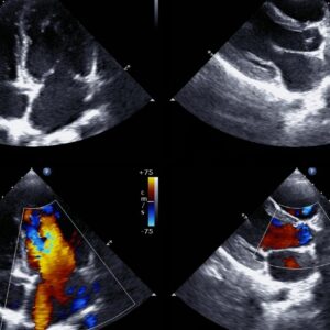 Diploma in Clinical echocardiography Part 1/2