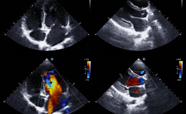 Diploma in Clinical echocardiography Part 1/2