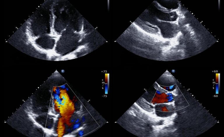 Diploma in Clinical echocardiography Part 1/2