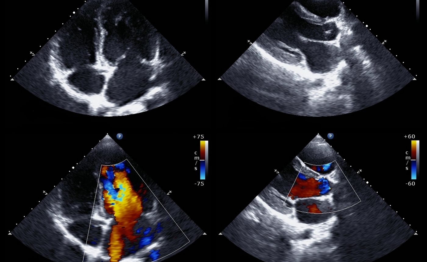 Diploma in Clinical echocardiography Part 1/2