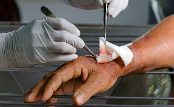 Diploma in Practical wound management & self care 2025