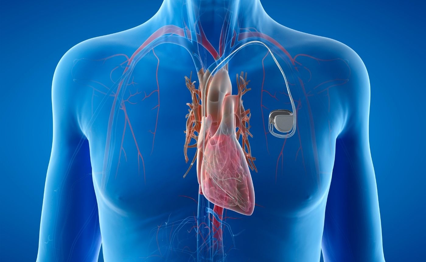 Diploma in Pacing (Pacemaker ICD)