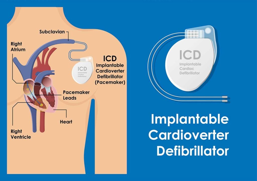 Cardiac Devices & Rhythm Management Diploma